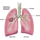 Illustration for article titled Penyakit Radang Paru Paru Akut Disebutem/em
